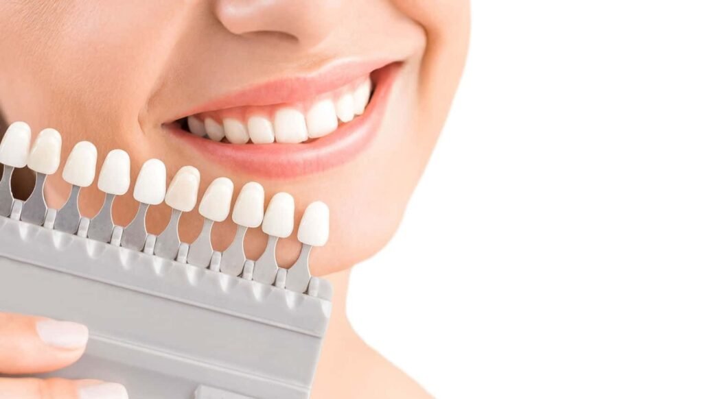 Dental Bonding Cost